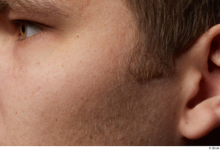 HD Face skin references Ethan Read cheek skin pores skin…